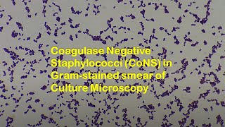 Coagulase Negative Staphylococci CoNS in Gram stained smear of culture Microscopy [upl. by Anyahc]