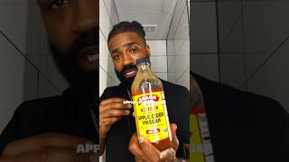 Receding Hairline This Liquid Gold Changes Everything Hair Loss Tips 3100 [upl. by Ahsiuqram]