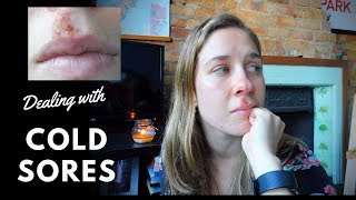 Opening up about Cold Sores Fever Blisters  Caths World [upl. by Akcir551]