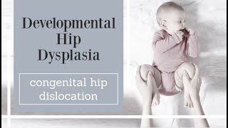 Developmental Hip Dysplasia  congenital hip dislocation [upl. by Roxane]