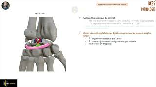 Imagerie des pathologies du DCSS [upl. by Anirahc]