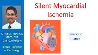 Silent myocardial ischemia [upl. by Atika]