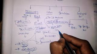 Laboratory diagnosis of leptospira [upl. by Fita]