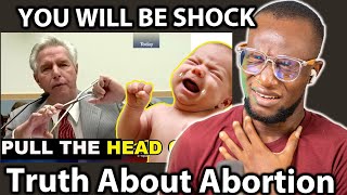 You Need To Watch How A Former Abortion Doctor Speaks On SHOCKING Truth About Abortion [upl. by Joellen]