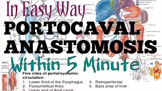 Portocaval Anastomosis In Easy Way Abdominal Anatomy [upl. by Dorothee]