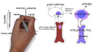 Comprendre le myÃ©lome multiple [upl. by Drew]