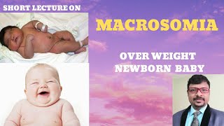 WHAT IS MACROSOMIA CAUSES OF OVER WEIGHT NEWBORN BABY FETAL MACROSOMIA [upl. by Ailhat]