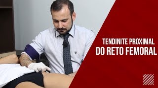 Tendinite Reto Femoral CUIDADO COM A ARTÉRIA [upl. by Anaillil237]