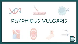 Pemphigus Vulgaris Oral Cavity Symptoms and Treatment [upl. by Tori]