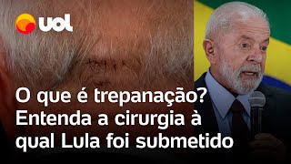 Lula faz cirurgia na cabeça presidente passa por trepanação para drenagem de hemorragia entenda [upl. by Entroc67]