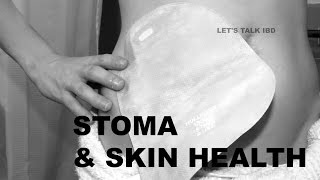 Stoma and Skin Health [upl. by Dichy609]