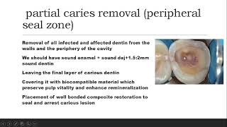 biomimetics2caries removal strategies [upl. by Noret]