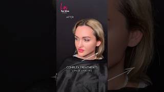 Complex lips amp jaw recommended рек top beauty aesthetic lifting lips skincare fullface [upl. by Khichabia]