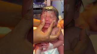 Nose massage babyreview newbornbaby morevews baby babyborn cute newborn love [upl. by Henryson]