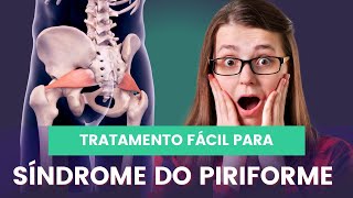 Sindrome do Piriforme fisioterapiaintegrativa fisioterapia colunasemdor sindromedopiriforme [upl. by Ohl3]