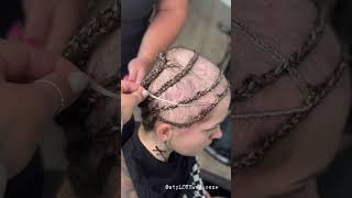 Sewing in Hair Extensions for Girl Recovering from Trichotillomania [upl. by Naashom]