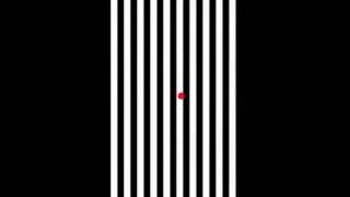 Modified Optokinetic [upl. by Surtimed]