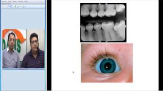 Radio Orthopedic Series Osteogenesis Imperfecta NEETPG USMLE integrated Medicine [upl. by Carolann]