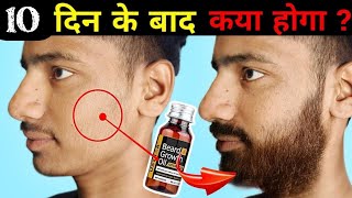 Ustraa Advanced Beard Growth Oil After 10 Days Review Best Beard Oil For Patchy Beard in India 2024 [upl. by Homovec]