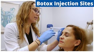 Botox Frontalis Glabella amp Nefertiti Treatment  Botox Injection Sites [upl. by Saixela278]