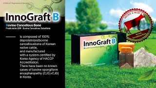 New Product Launch Introducing InnoGraft B with Clinical Case [upl. by Rowe]