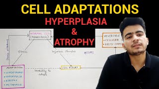 Hyperplasia amp Atrophy  Cell Adaptations 23  General Pathology  EOMS [upl. by Dupre]