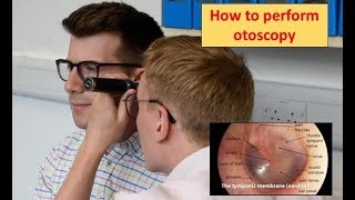 How to perform Otoscopy Ear Exam [upl. by Aronoel]