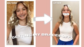 IM GETTING MY BRACES OFF  vlog [upl. by Anerbes]