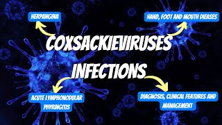 Coxsackievirus Infections Herpangina Pharyngitis and Hand Foot and Mouth Disease [upl. by Amimej9]