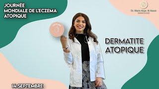 Dermatite atopique Eczéma atopique [upl. by Pollyanna]