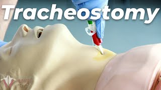 How to Perform a Tracheostomy [upl. by Brianne188]