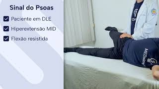 Sinal do Psoas  EXAME ABDOMINAL [upl. by Nosredneh]