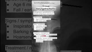 Croup laryngotracheitis [upl. by Derte]