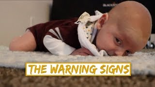 SIGNS OF LOW MUSCLE TONE IN BABIES  Hypotonia [upl. by Noisla]