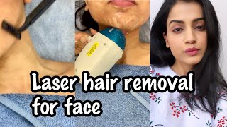 LASER HAIR REMOVAL FACE  My Experience of Facial Laser Hair Removal  Laser Hair Removal in India [upl. by Idyh]