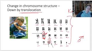 deletions and translocations [upl. by Clie900]