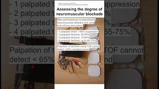 Assessing the degree of neuromuscular blockade [upl. by Rycca80]