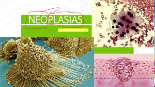 Patologia Geral  Neoplasias [upl. by Atarman]