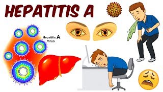 Hepatitis A [upl. by Odnalo]