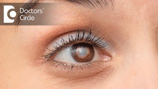 Which is the best Intraocular Lens suited for eyes Dr Samina F Zamindar [upl. by Yelyab402]