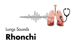 Rhonchi  Lung Sounds  Medzcool [upl. by Thesda]