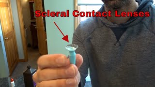 Scleral Lenses after Laser Eye Surgery [upl. by Jocko]