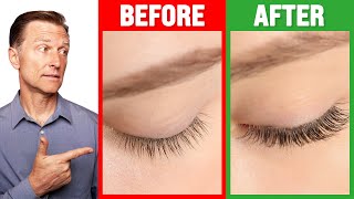 How to Grow Long Thick Eyelashes QUICKLY  Dr Berg [upl. by Rora]