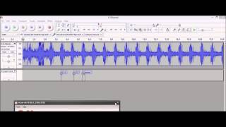 Heart and breath sounds records with homemade digital stethoscope [upl. by Garap703]