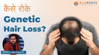 Genetic Hair Loss को कैसे रोके  How to control Genetic Hair Loss  Explained by Dr Alok Sahoo [upl. by Koziara]