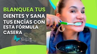 DIENTES MÁS BLANCOS Y ENCÍAS MÁS SANAS CON ESTA FÓRMULA NATURAL [upl. by Enirbas]