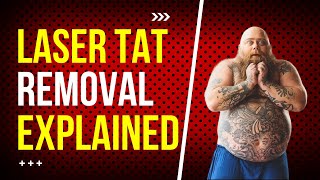 The Truth About Laser Tattoo Removal  Dr Undo Tattoo [upl. by Suzette]