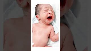 Neonatal baby admit in nicubaby nicu doctor subscribemychannel 🙏hospital 🏥🏥 [upl. by Nahk]