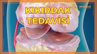 KIKIRDAK SORUNLARI NELERDİR KIKIRDAK TEDAVİLERİ NASIL YAPILIR [upl. by Imailiv]