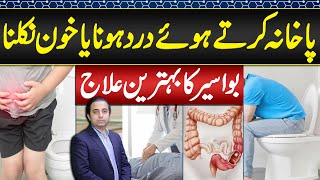 Piles Symptoms and Treatment  Bawaseer Ka Ilaj or Alamat  Symptoms and Treatment of Hemorrhoids [upl. by Melan148]